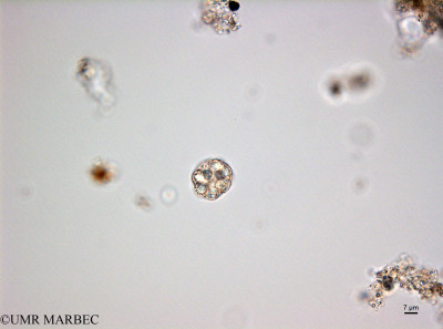 phyto/Bizerte/bizerte_bay/RISCO February 2015/Coelastrum sp (ancien Baie_T5_CWD1_Ind3-160202_001_ovl-10).tif(copy)_thumb.jpg